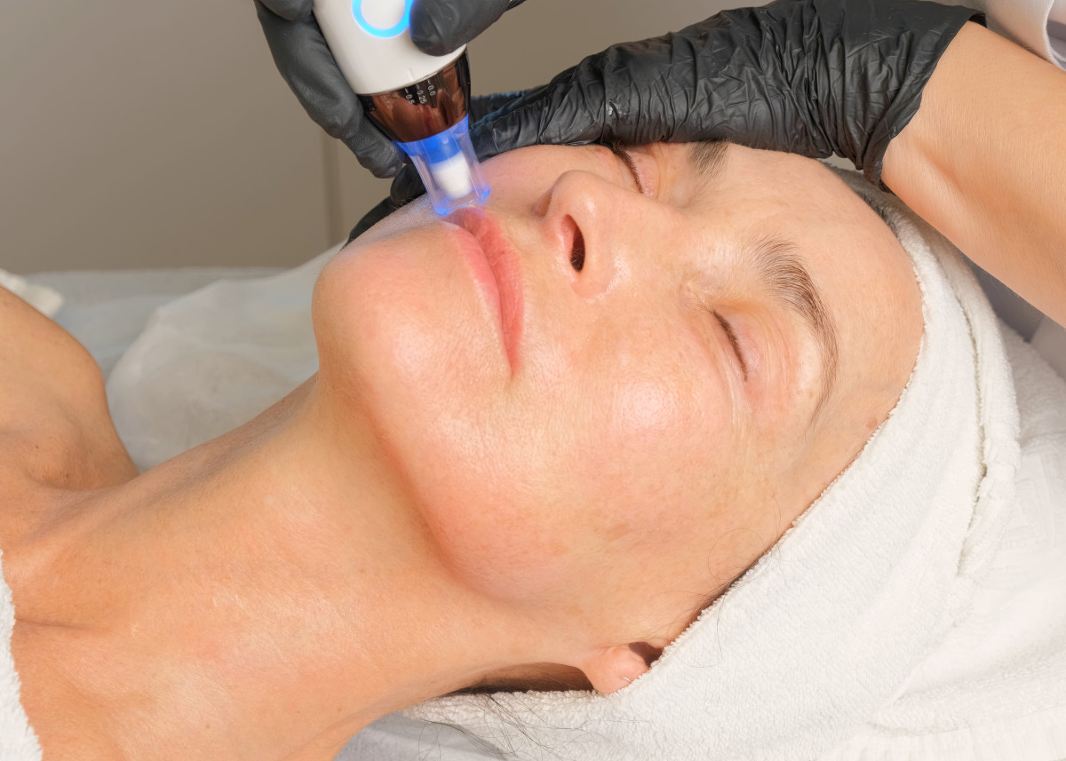 Facial of the Month preview article image